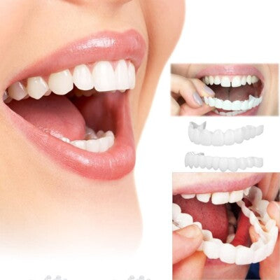 SmileSnap™ Snap-On Veneers